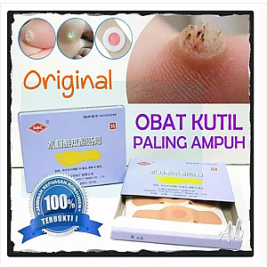 Plester Obat Kutil & Mata Ikan Penutup Kutil Koyo Kutil ji yan gao &ndash; A201